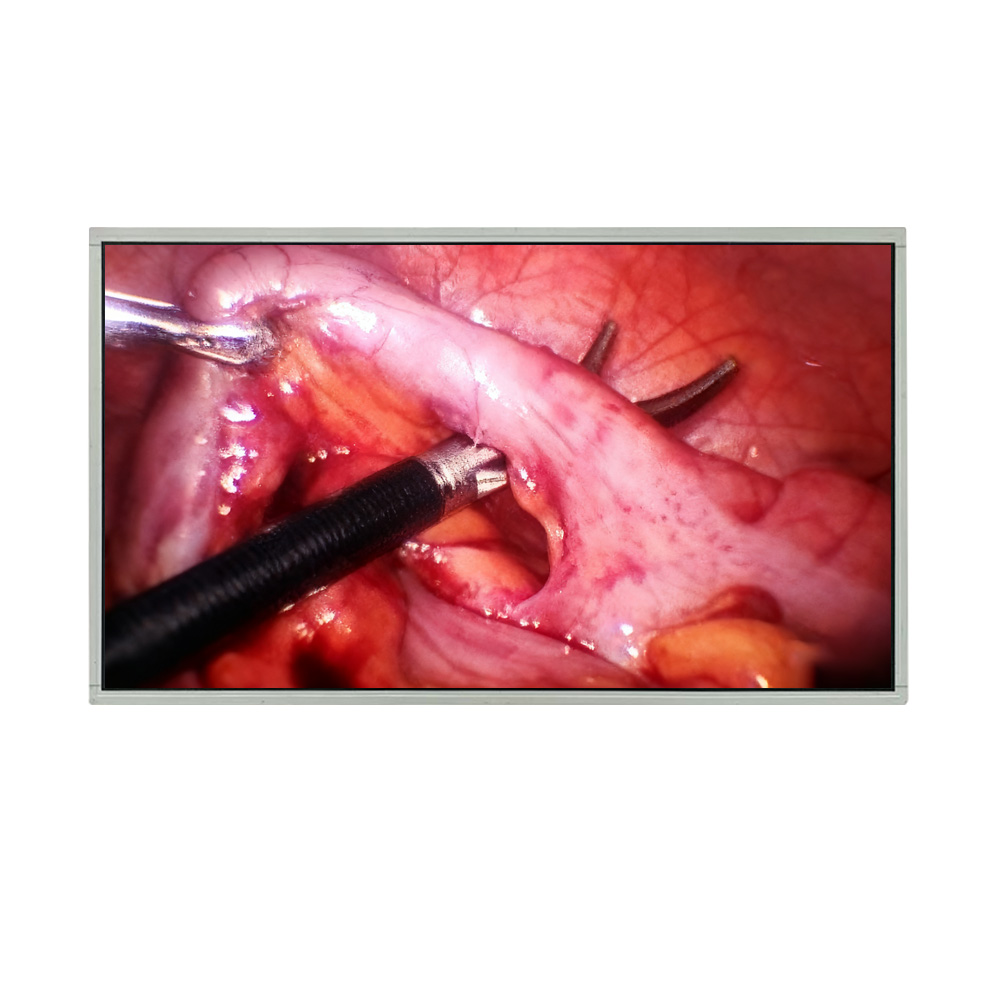 High-Resolution 32-Inch Medical LCD Module for Diagnostic and Surgical Equipment