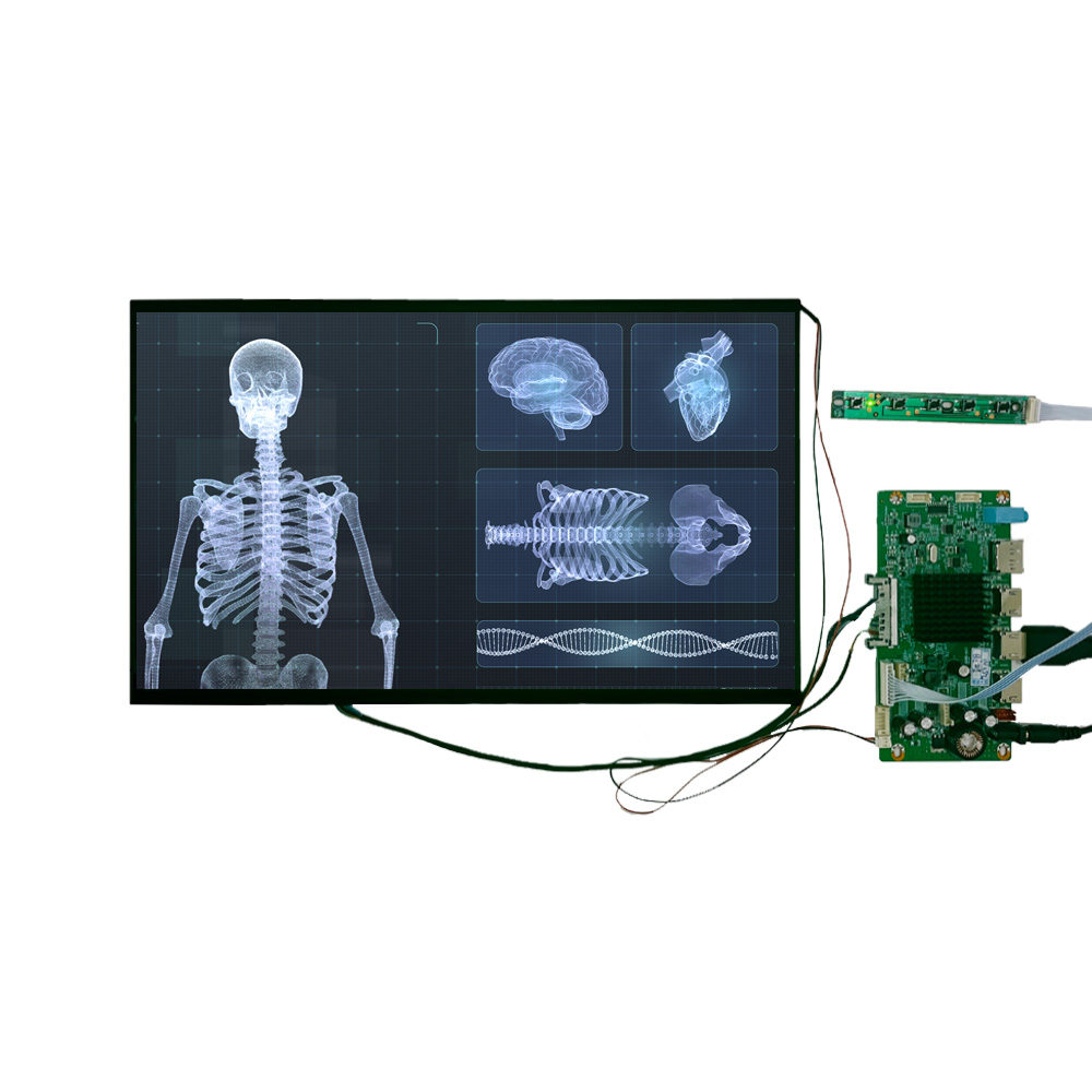 15,6-Zoll 4K Medical Display Module für hochpräzise diagnostische Bildgebung