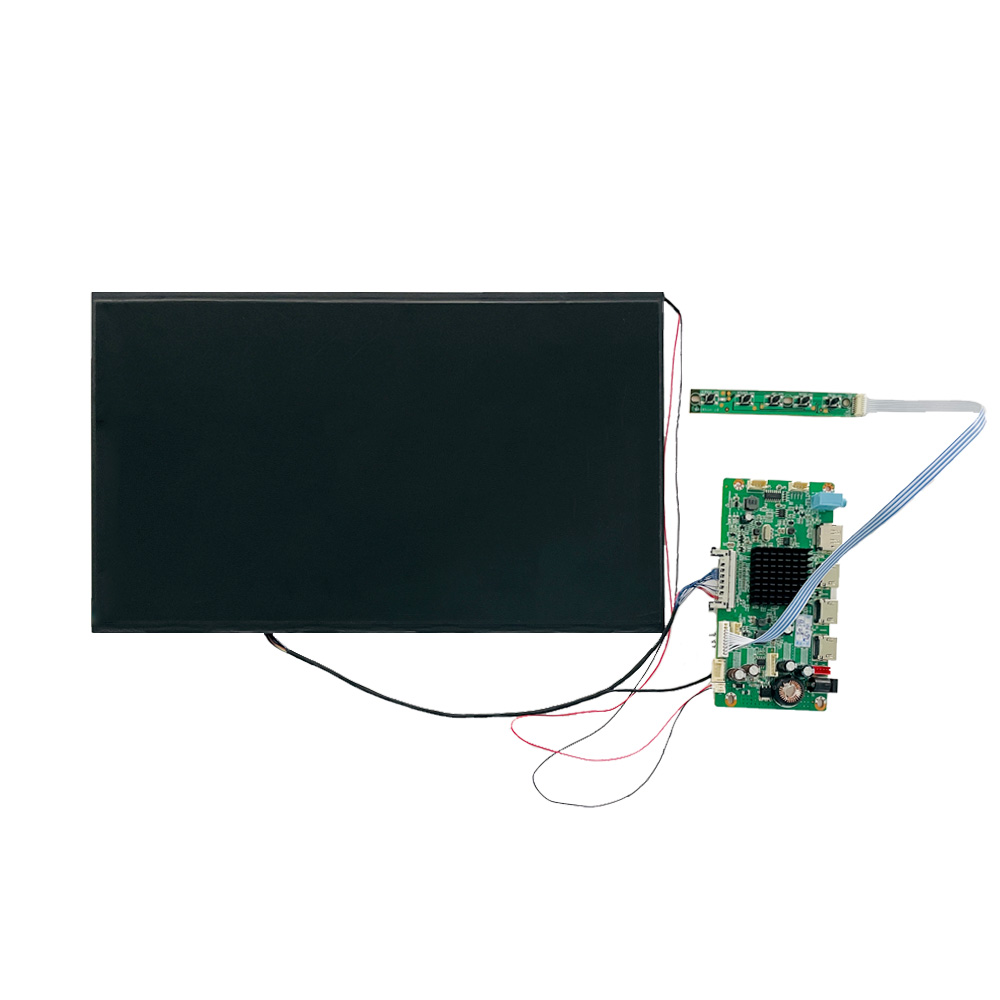 How High-Resolution Medical Displays Improve Radiology Diagnostics