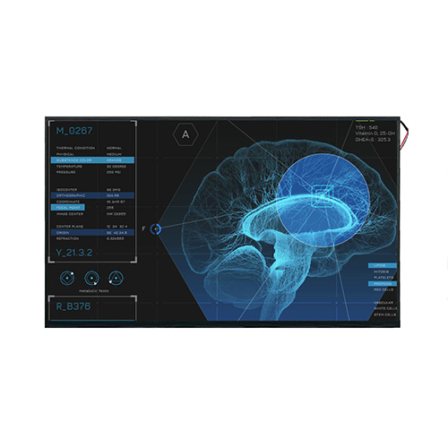 How High-Resolution Medical Displays Enhance Surgical Visualization and Precision