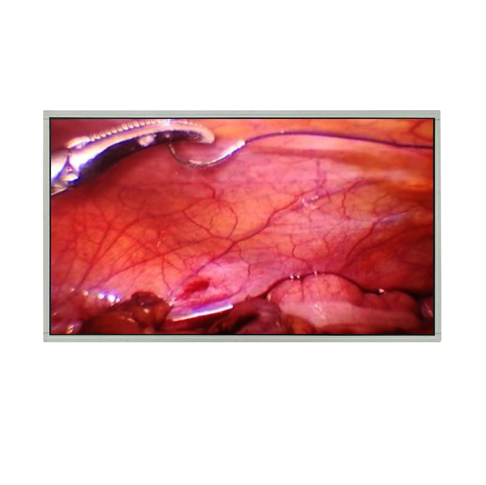 Why High-Resolution Medical Displays Are Essential in Diagnostic Imaging